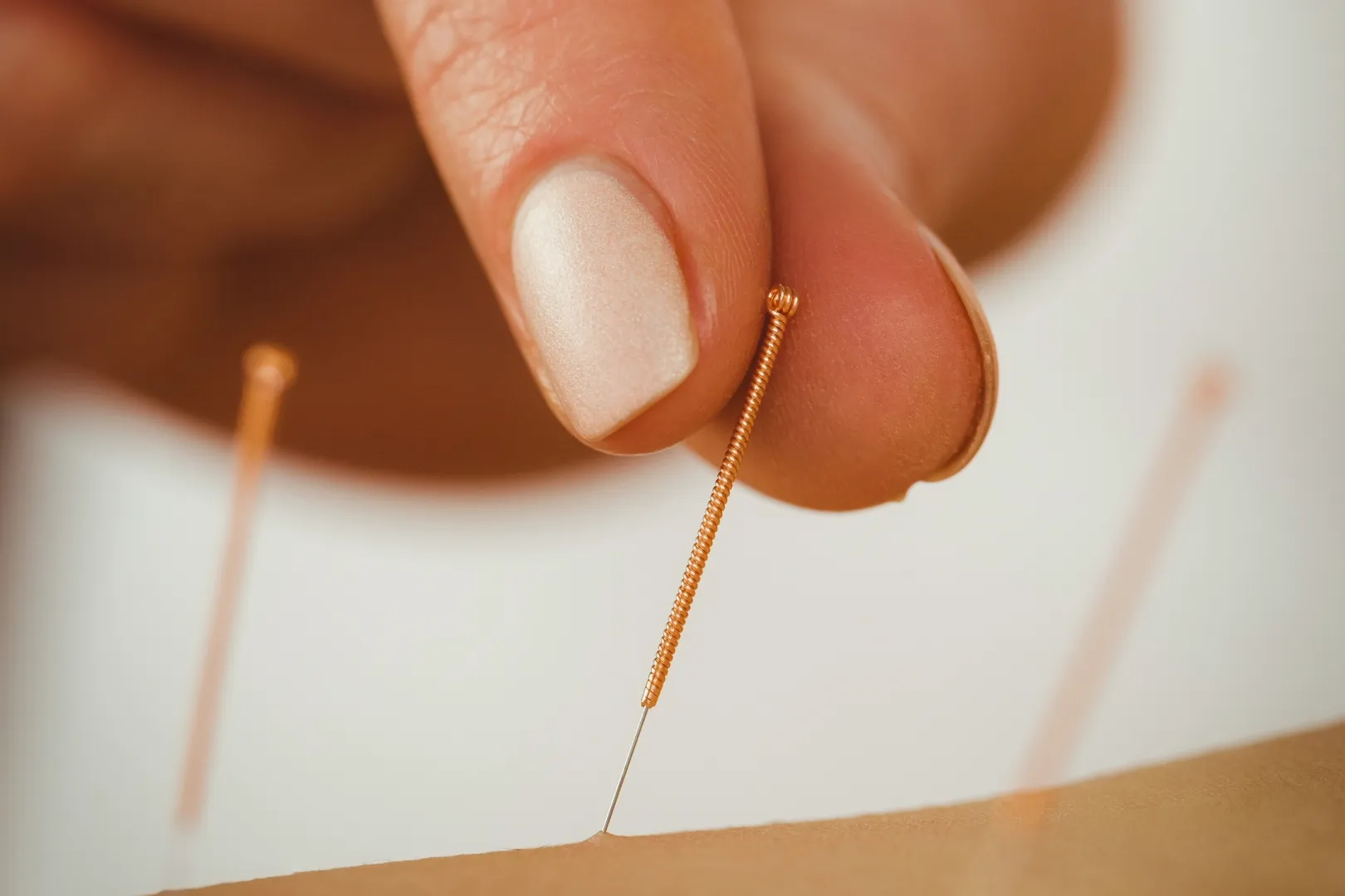 Acupuncture needles being applied with heat lamp
